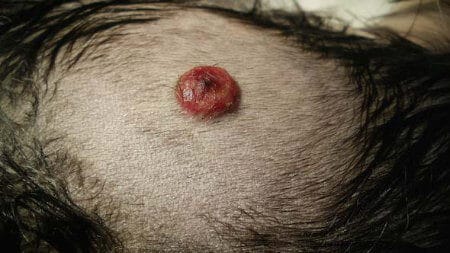 kožne bolezni psov - slike: bradavice