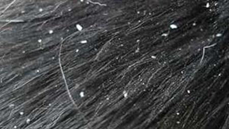 kožne bolezni psiv prhljaj