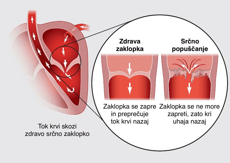Srčno popuščanje pri psih